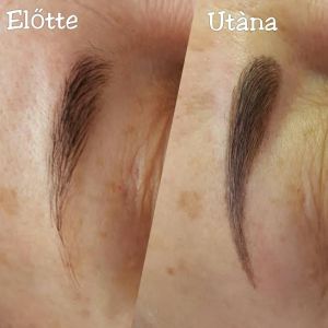 poros szemöldök korrekció előtt